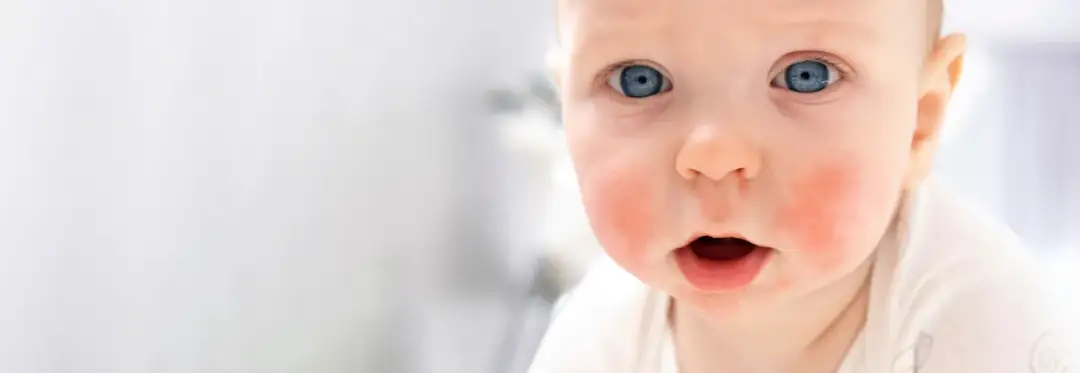 Czy banan uczula niemowlaka? Objawy i bezpieczeństwo dla dzieci