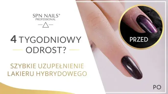 Dopuszczalny odrost paznokci: normy estetyczne i zawodowe