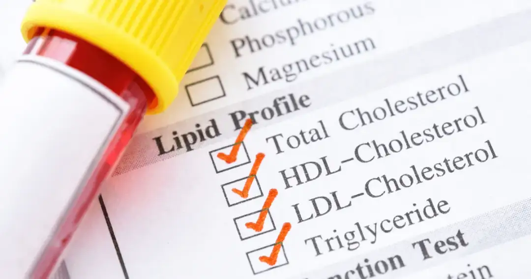 Jak się przygotować do badania cholesterolu, by uniknąć błędów?