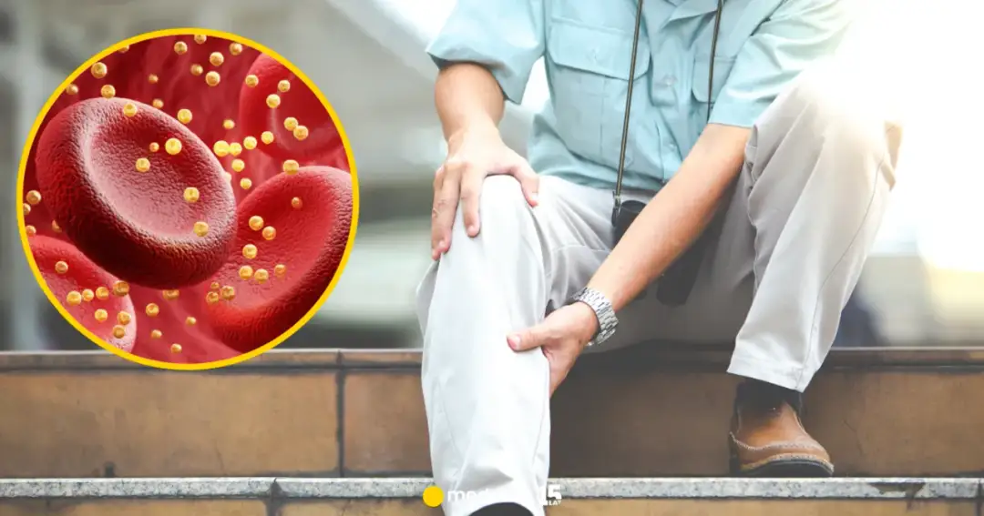 Wysoki cholesterol: Cichy zabójca. Poznaj skutki dla zdrowia!