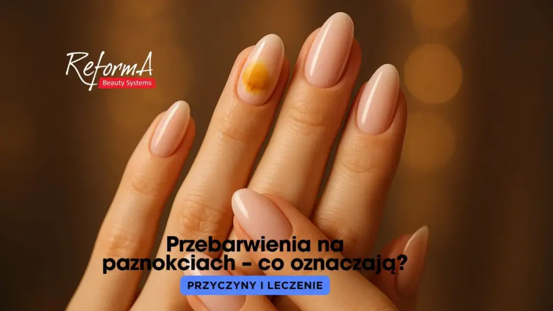 Pomarańczowe paznokcie: moda czy sygnał zdrowia?