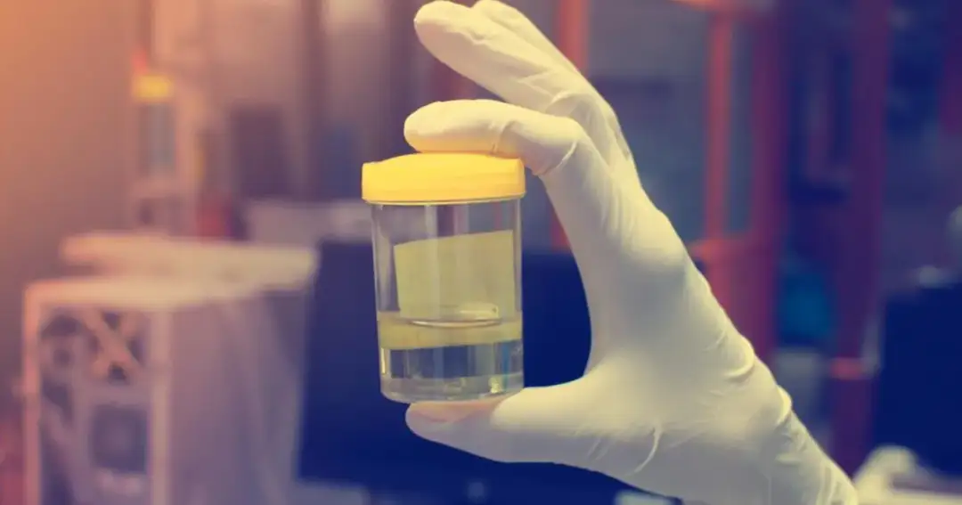 Czy w badaniu moczu wyjdzie nikotyna? Oto co musisz wiedzieć