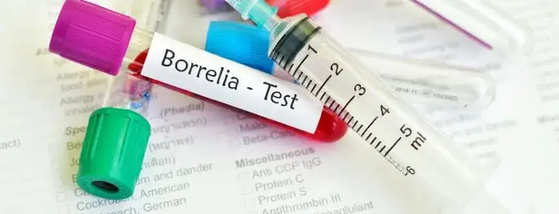Badanie na boreliozę: Na czczo? Wszystko, co musisz wiedzieć.