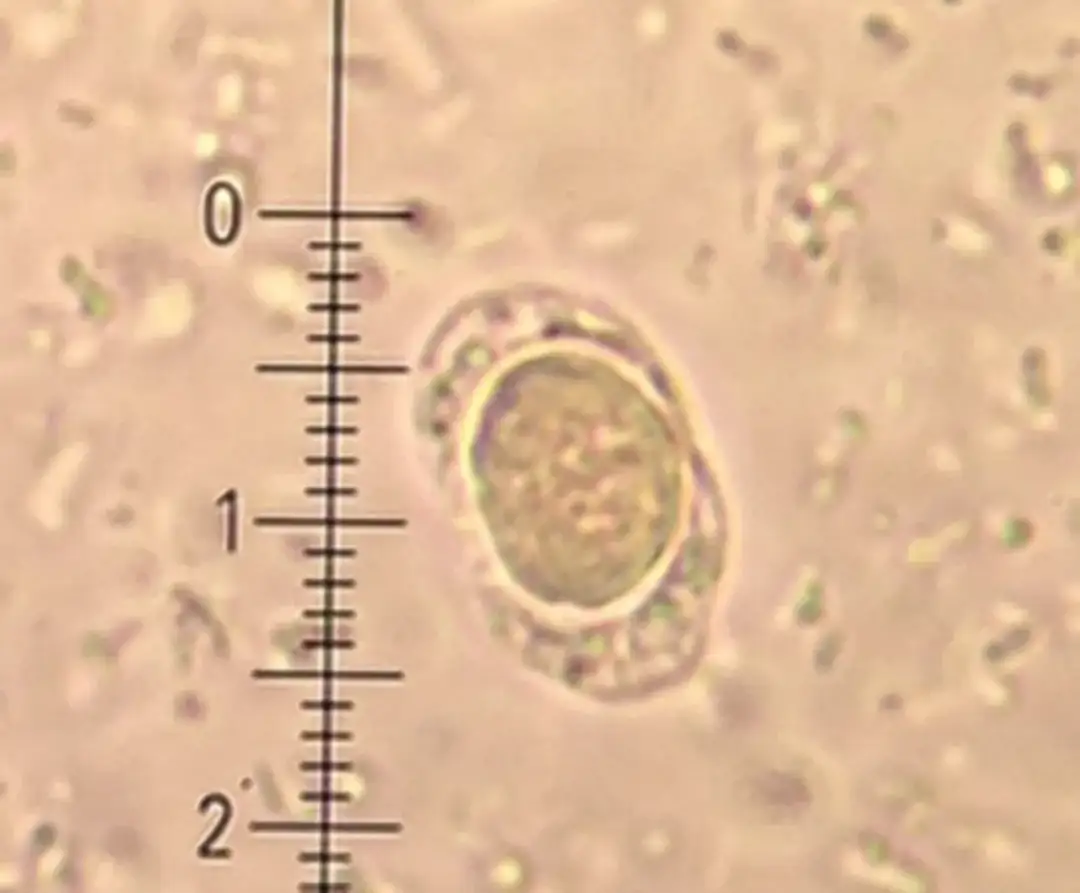 Blastocystis hominis - charakterystyka, objawy i naturalne leczenie