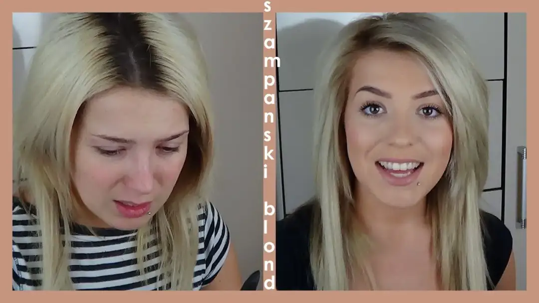 Jak skutecznie usunąć żółte odrosty i zapobiec ich powstawaniu – praktyczne porady