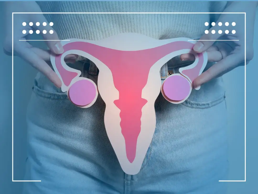 Torbiel na jajniku: objawy i ból pleców, które musisz znać