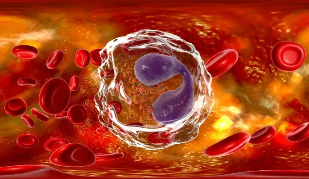 Podwyższony poziom eozynofili: najczęstsze przyczyny i objawy choroby