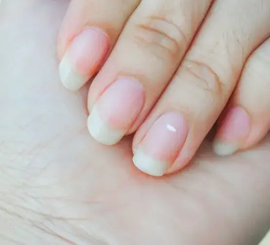 Czy olejek rycynowy jest dobry na paznokcie? Odkryj jego mocne efekty