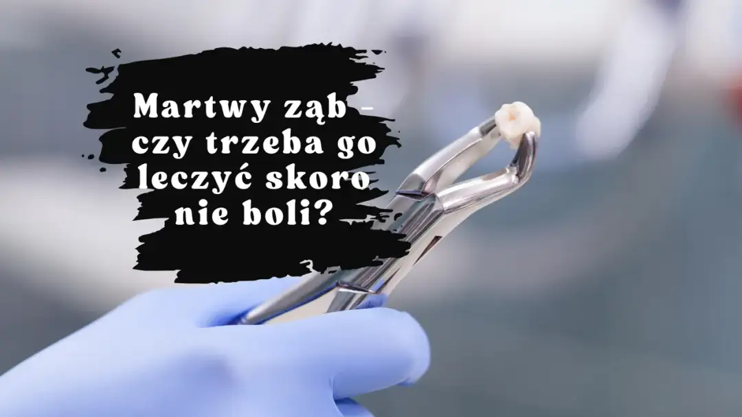 Nagły ból zęba w sobotę? Znajdź dentystę i ulgę krok po kroku