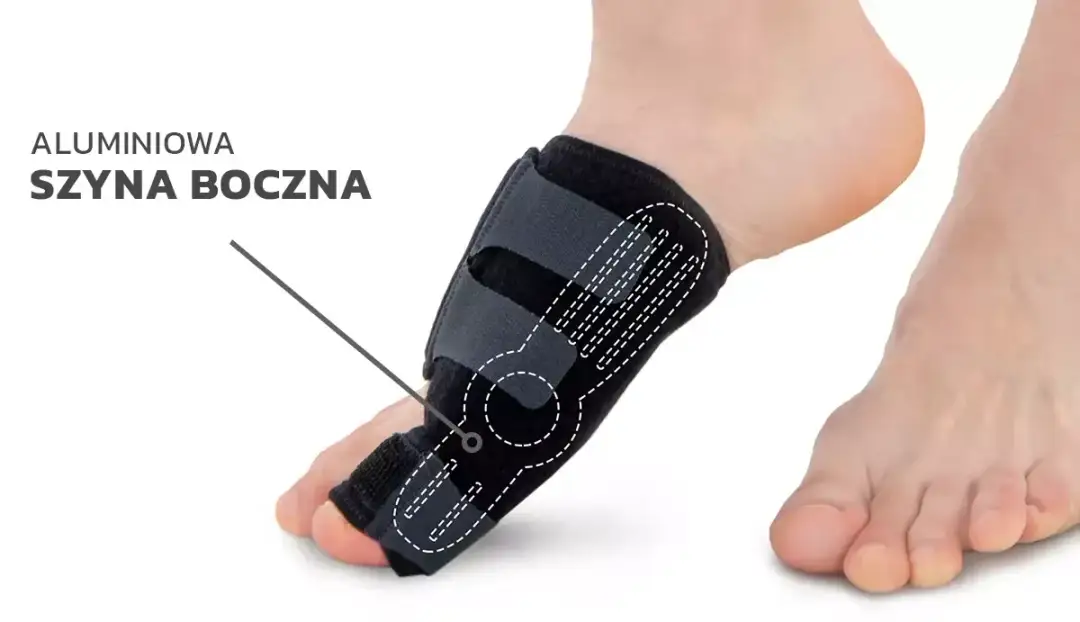 Ortezy na haluksy: Prawda o ich skuteczności. Co musisz wiedzieć?