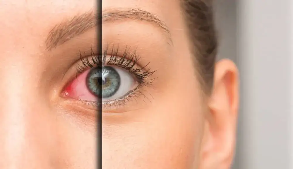 Choroby wzroku objawy: Jak rozpoznać niebezpieczne symptomy?