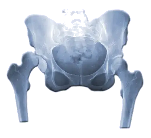 Skręcenie stawu biodrowego objawy – jak je rozpoznać i leczyć