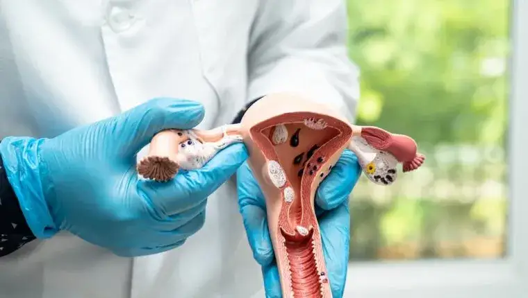 Polip szyjki macicy - doświadczenia kobiet i porady ginekologów