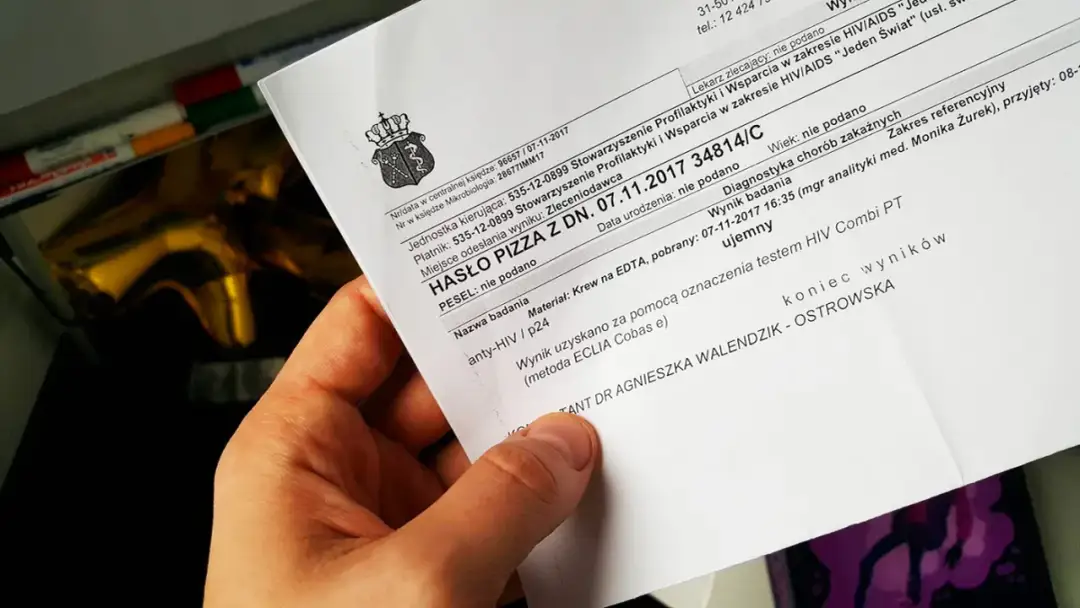 Jak wygląda badanie na HIV? Co musisz wiedzieć przed testem