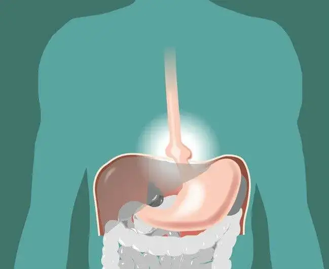 ICD-10: Przepuklina rozworu przełykowego – co warto wiedzieć?