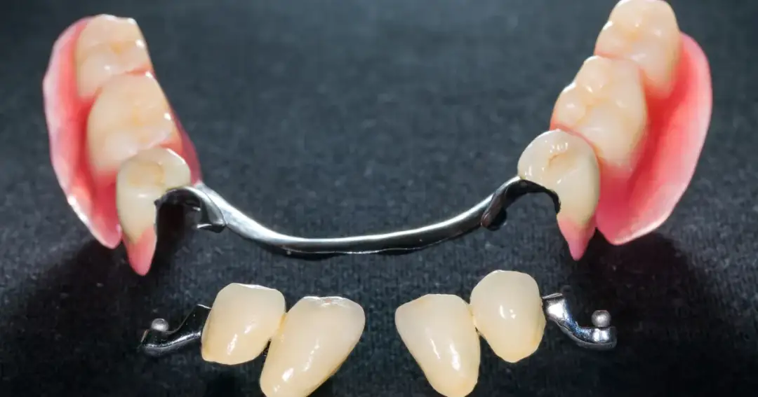 Jak często przysługuje proteza zębowa nfz i co musisz wiedzieć