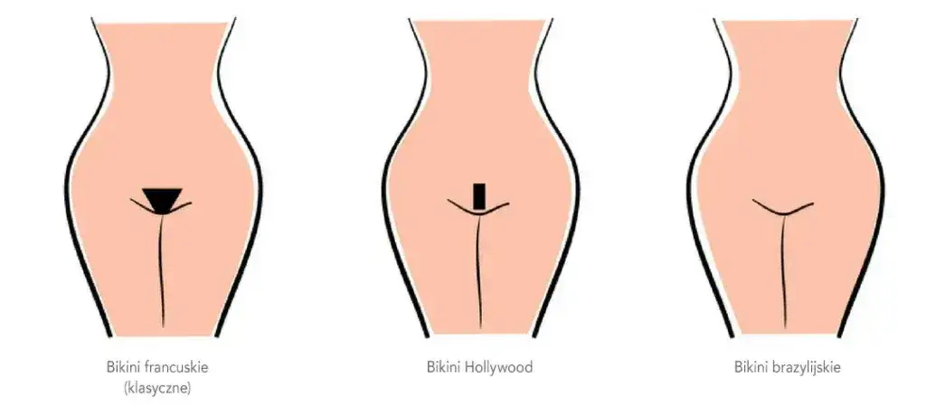 Depilacja laserowa bikini: Ile trwa? Pełny harmonogram i efekty