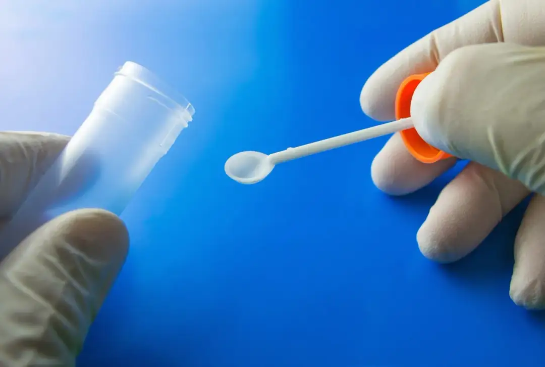 Ile kosztuje badanie kału na pasożyty? Ceny w różnych laboratoriach