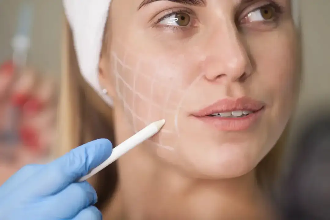 Gładka skóra po laserze? Tych zakazów nie możesz ignorować!