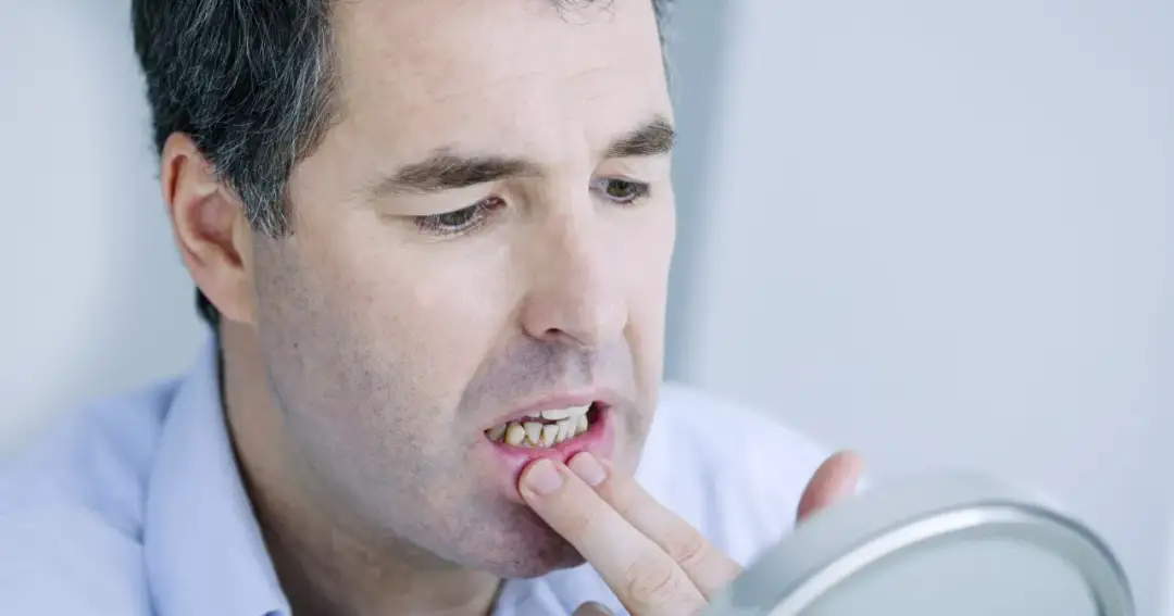 Ból dziąseł: Przyczyny, domowe sposoby i kiedy iść do dentysty