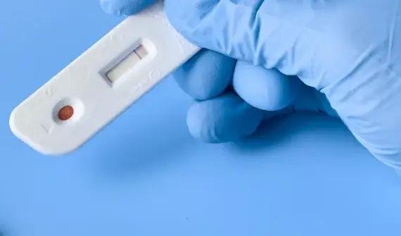 Co to jest CRP i ile kosztuje badanie - praktyczny poradnik 2025