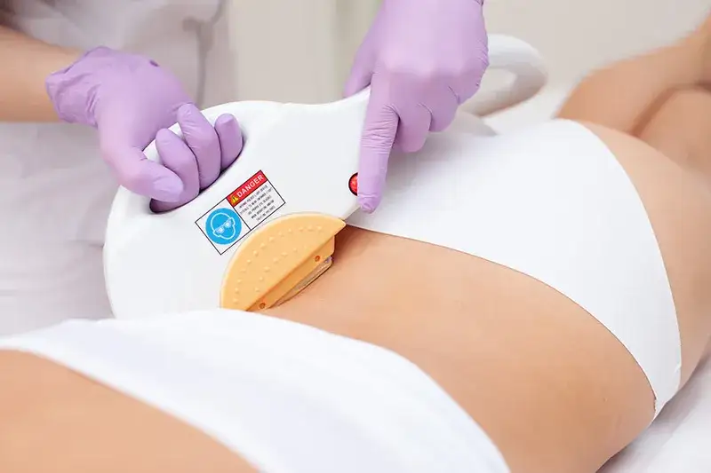 Depilacja brazylijska co to? Poznaj metody, ból i ceny zabiegu