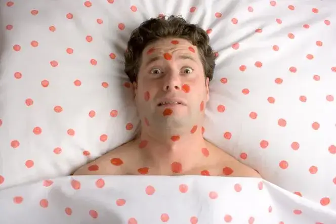 Różyczka a bezpłodność u mężczyzn: fakty i zagrożenia dla płodności