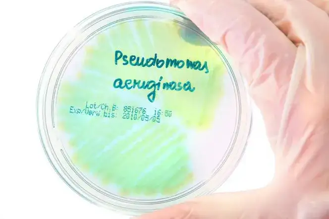 Pseudomonas aeruginosa w moczu: Co oznacza dla Twojego zdrowia?
