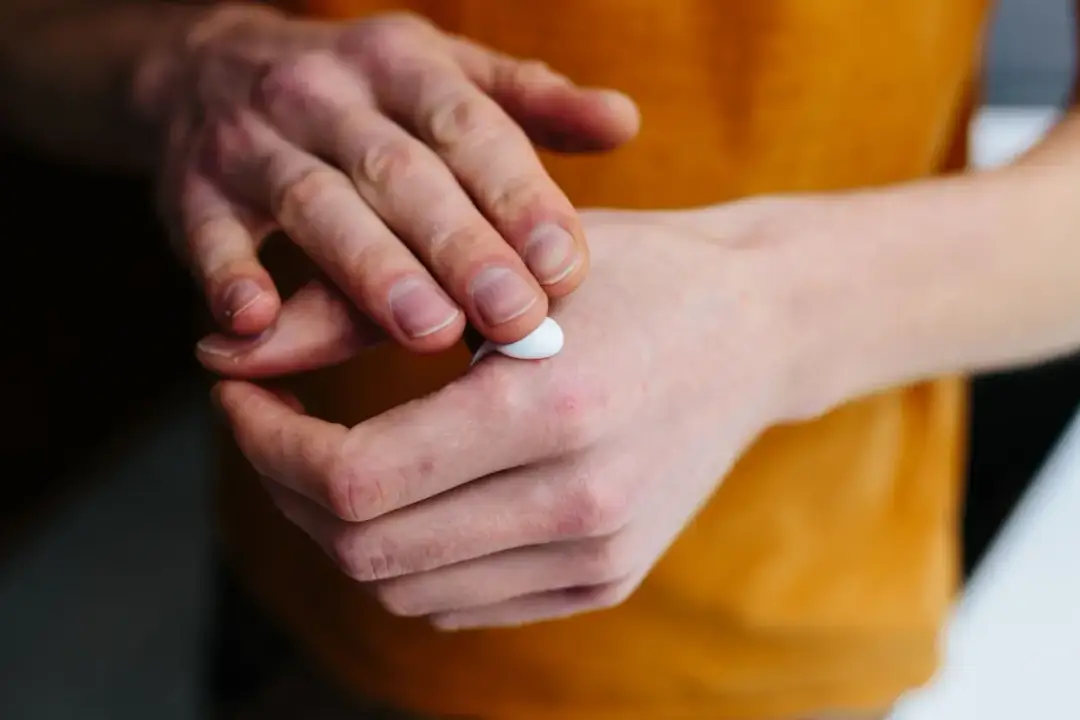 Pimafucort czy na receptę? Sprawdź, zanim kupisz ten lek