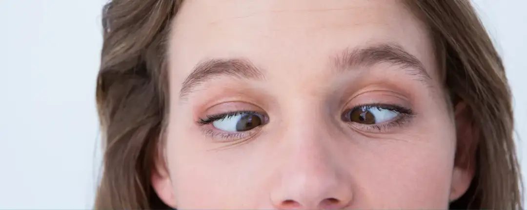 Czy zez jest dziedziczny? Poznaj genetyczne aspekty i ryzyko w rodzinie