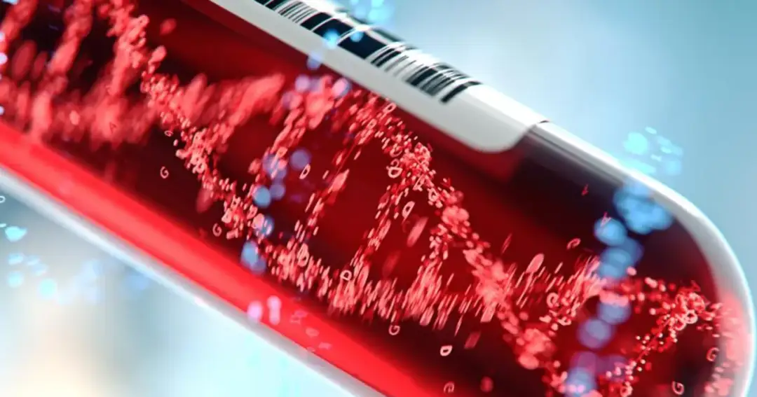 Podwyższony poziom MCV: przyczyny i leczenie tego stanu chorobowego