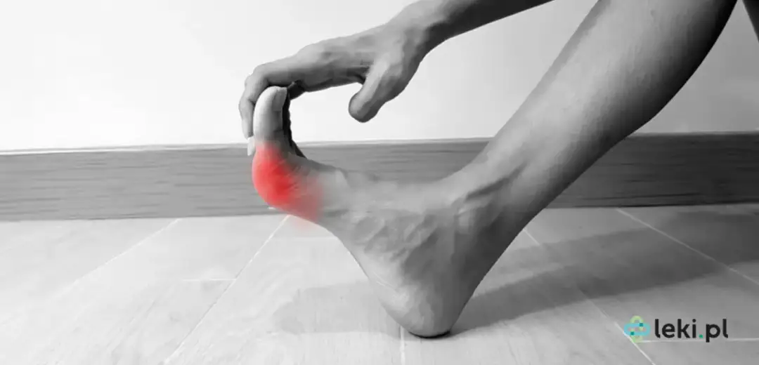 Dna moczanowa: Szybka ulga w bólu? Leki bez recepty i domowe sposoby.