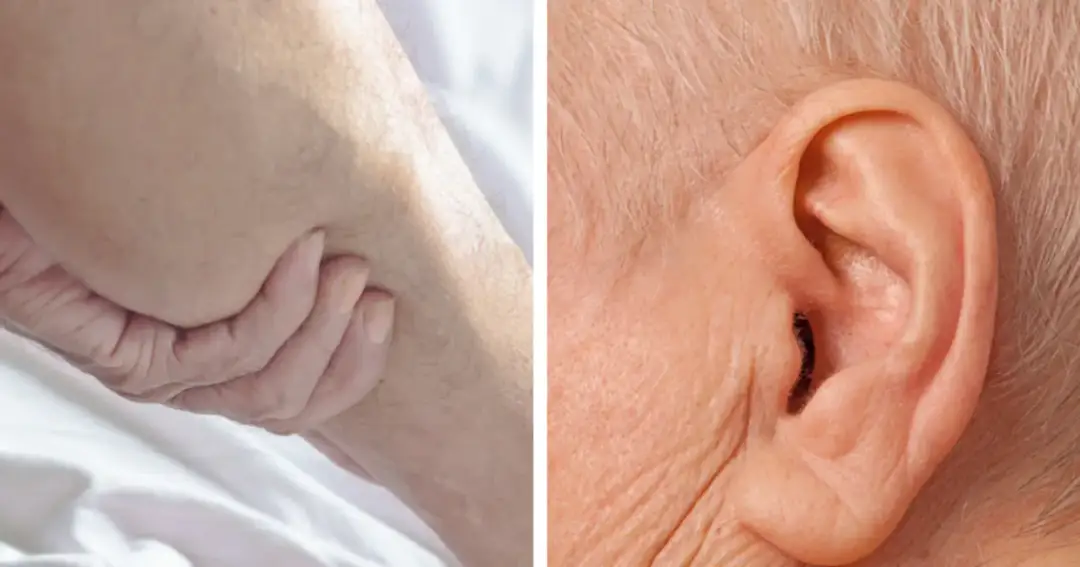 Miażdżyca: objawy psychiczne i wpływ na mózg rozpoznaj sygnały