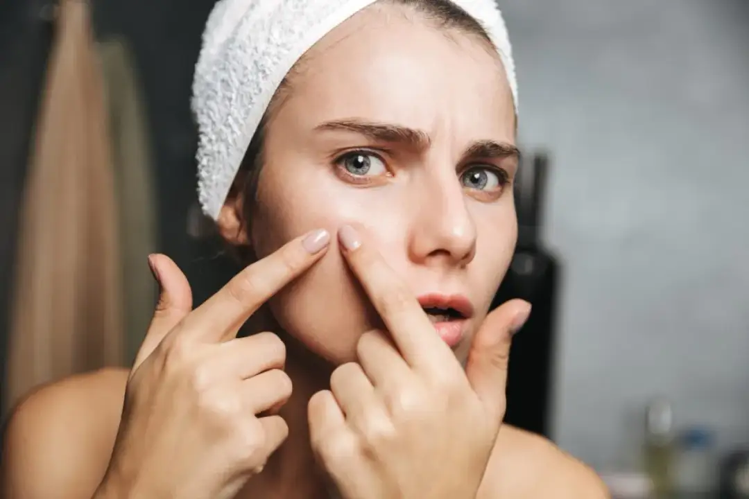 Podskórny pryszcz: Co działa, a czego unikać? Rada eksperta