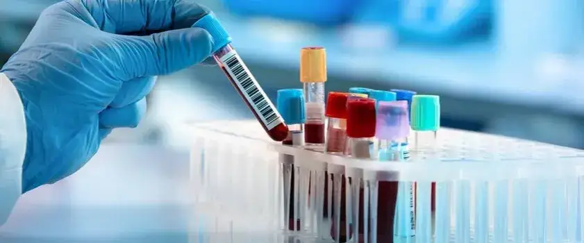 Ile kosztuje badanie magnezu? Sprawdź ceny w Twojej okolicy