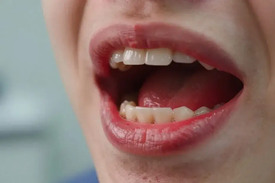 Podrażnione dziąsła? Sprawdzone sposoby i kiedy iść do dentysty