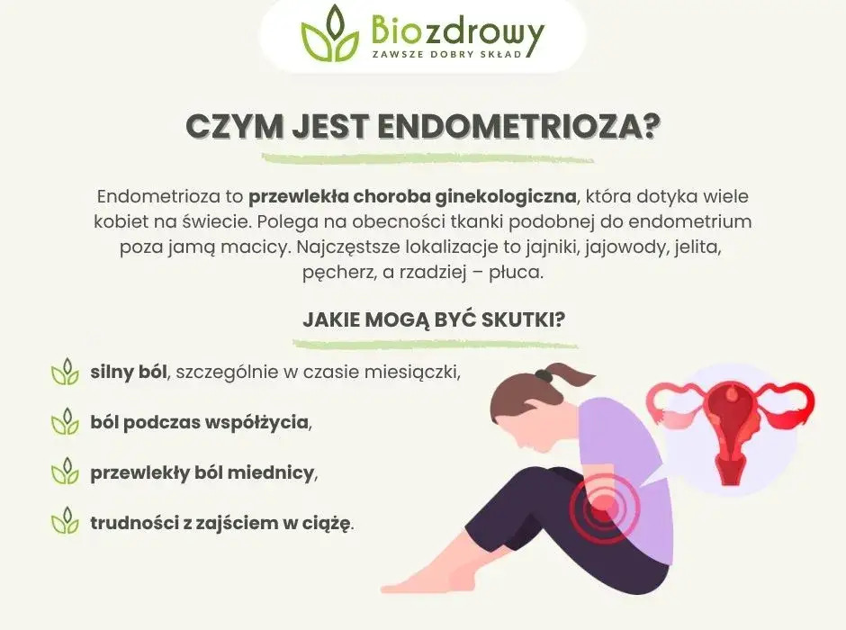 Endometrioza: Jakie leki? Skutki, płodność i nowe terapie w PL