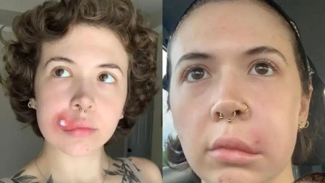 Trójkąt śmierci objawy – nie lekceważ tych groźnych sygnałów