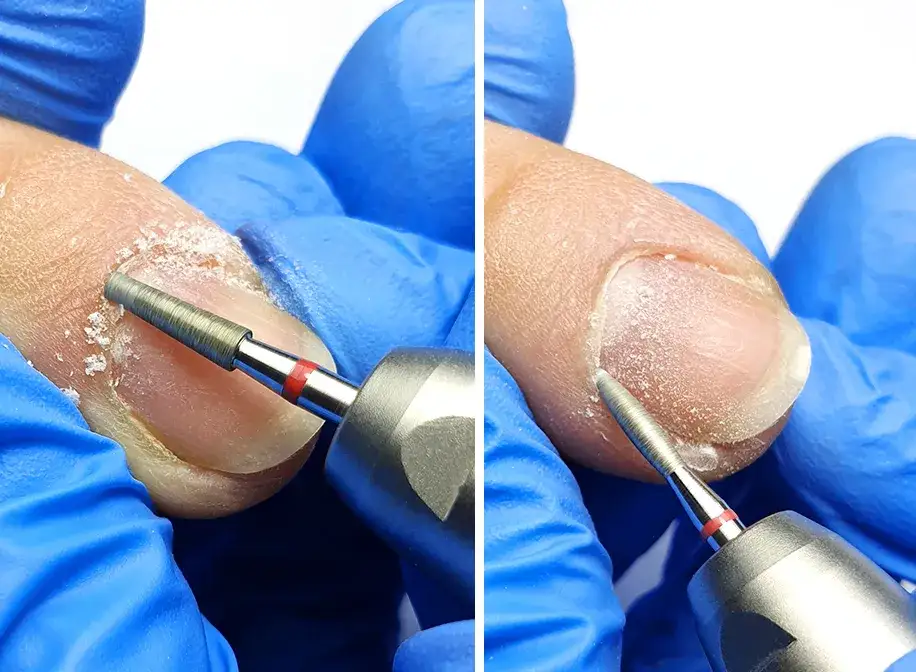 Jak obciąć skórki na paznokciach: 9 bezpiecznych kroków