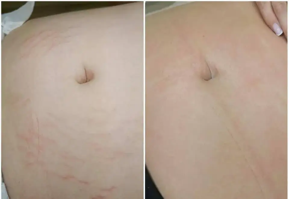 Gdzie kupić deep phyto peeling i uniknąć nieefektywnych produktów