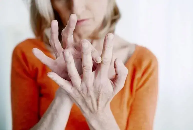 Reumatyzm - Pierwsze Objawy, Które Musisz Znać. Wczesna Diagnoza