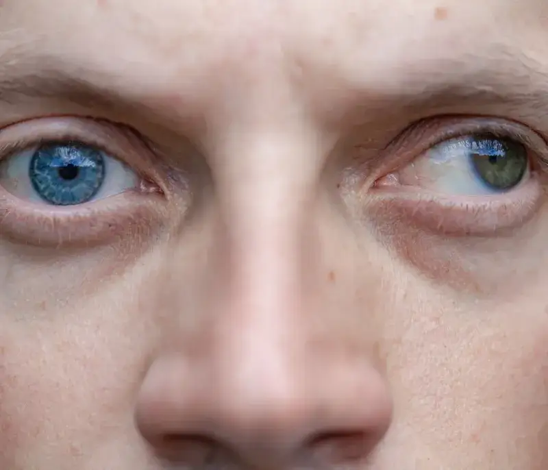 Kiedy do okulisty przy zezie u niemowlaka? Objawy i zalecenia