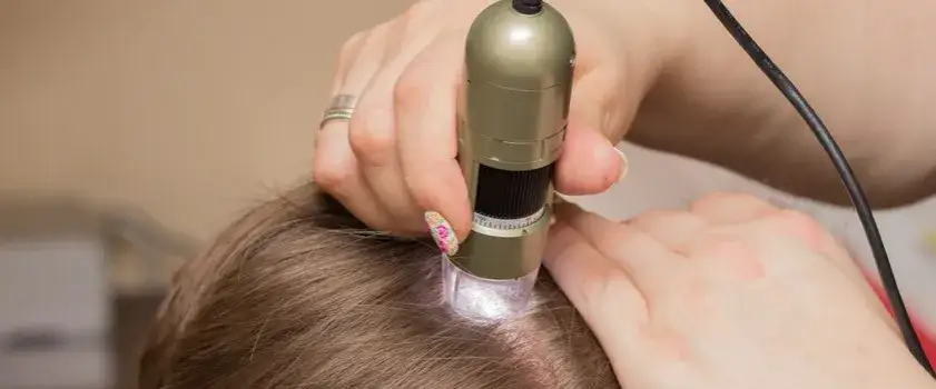 Czy trycholog jest na NFZ? Dowiedz się, dlaczego nie jest refundowany