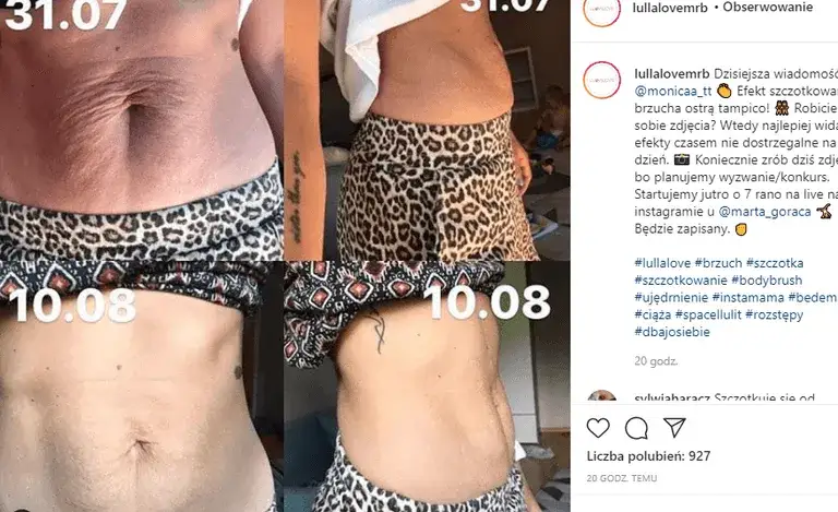 Szczotkowanie brzucha - jakie efekty przynosi dla zdrowia i urody?