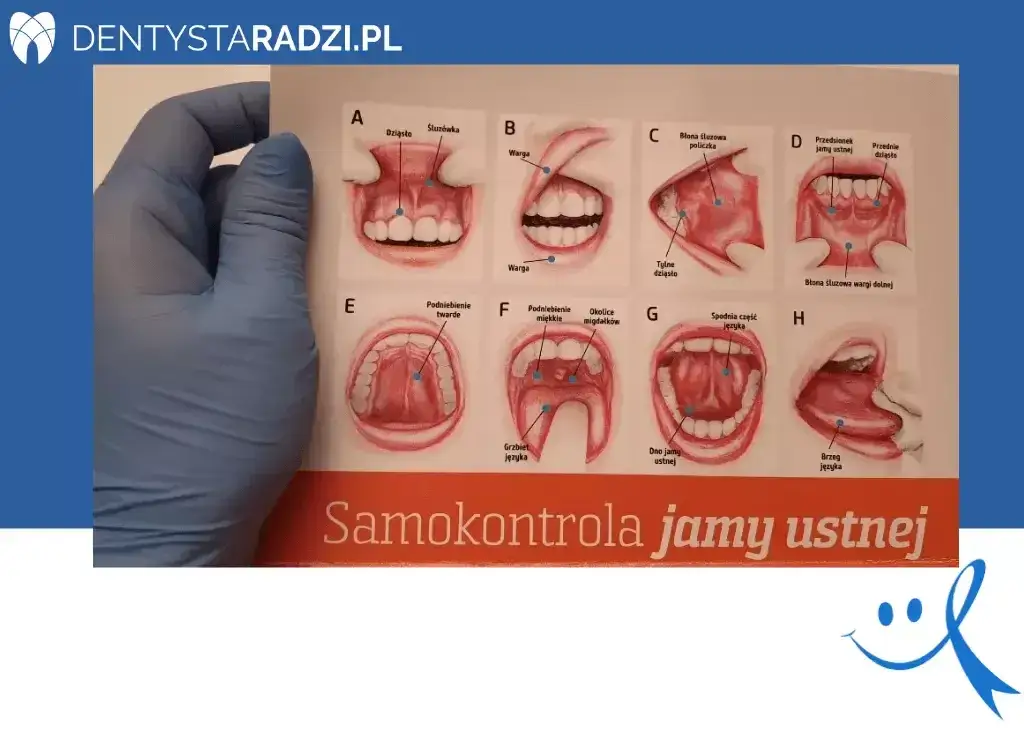Rak jamy ustnej: objawy, zdjęcia. Sprawdź, co powinno Cię zaniepokoić