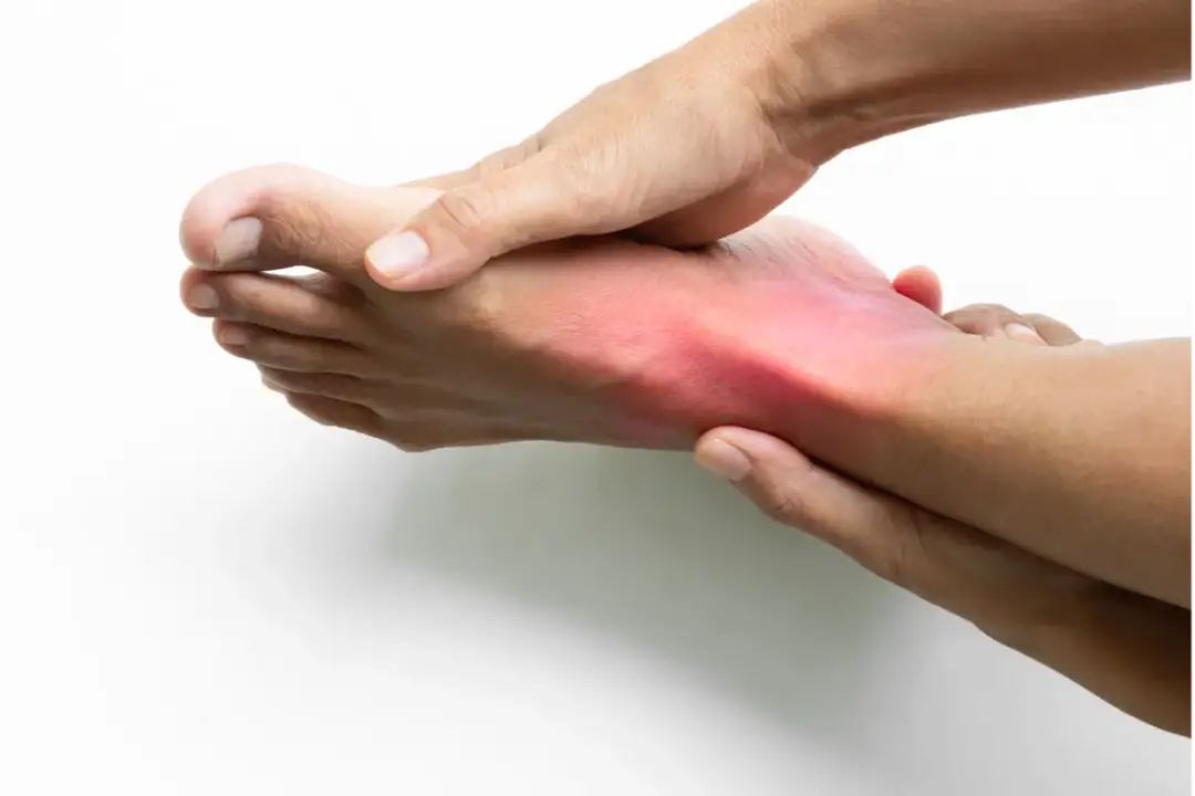 Jak skutecznie leczyć skręcenie śródstopia i uniknąć powikłań