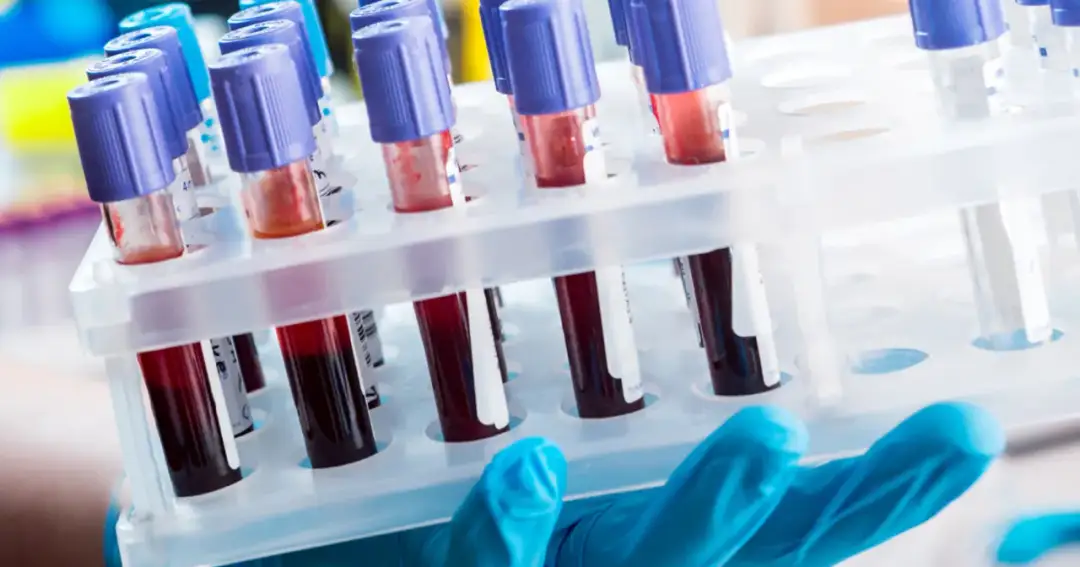 Diagnosta laboratoryjny i inni: Kto odpowiada za Twoje wyniki?