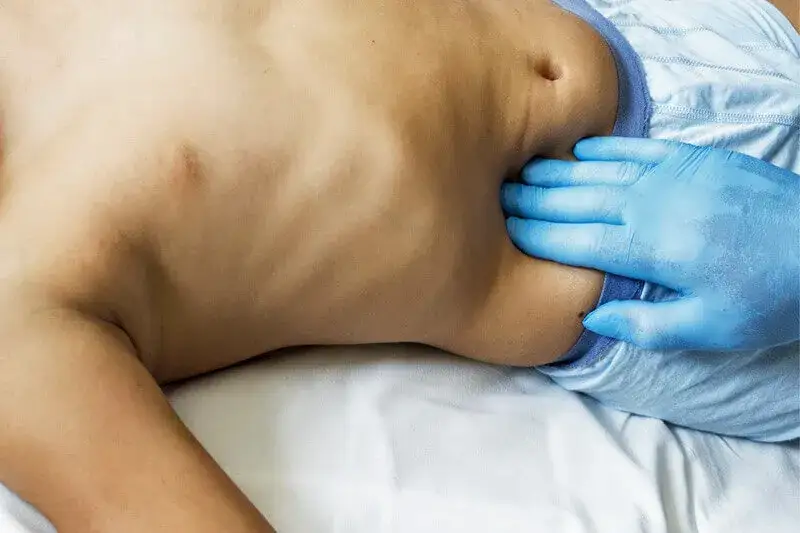 Wichtige Symptome einer Blinddarmentzündung: So erkennen Sie sie rechtzeitig