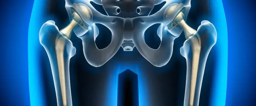 Bóle biodra przyczyny: odkryj, co może powodować Twój dyskomfort