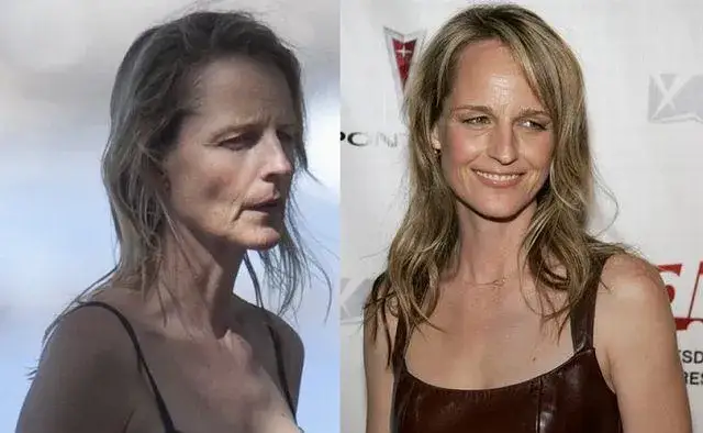 Helen Hunt operacje plastyczne - szokująca prawda o metamorfozie gwiazdy